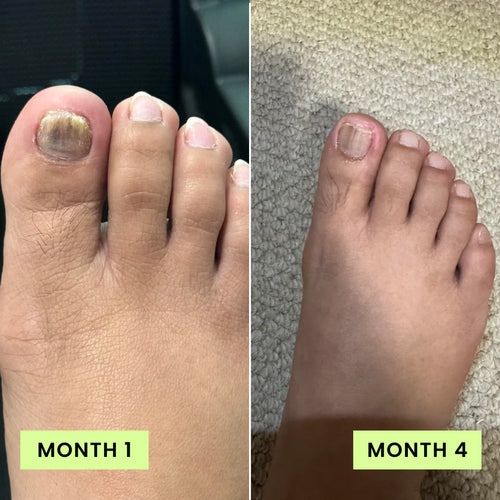 AURALUNA FUNGAL DEFENSE SYSTEM™